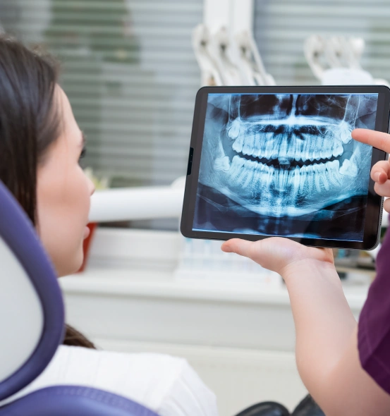 Dentist reviewing a digital dental X ray with a patient